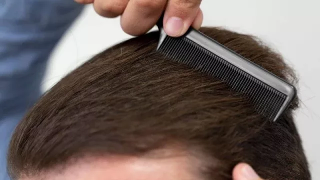 ¿Se te cae mucho el cabello? Estas son las posibles causas y el tratamiento
