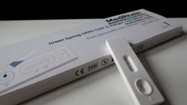 Cadenas de farmacias comercializarían autotest de COVID-19 a fin de mes (su precio sería de G. 90.000)