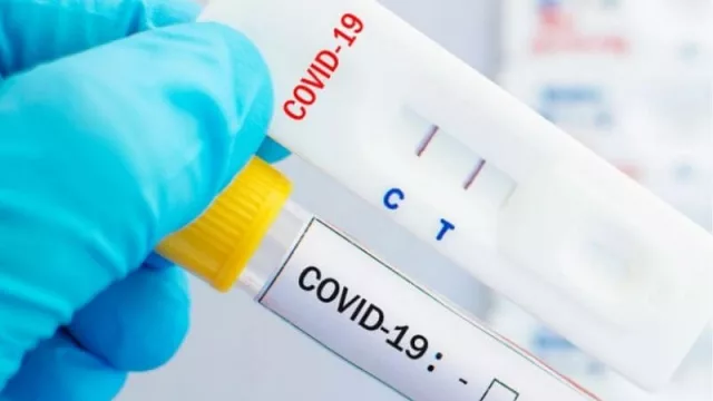 Los hisopados, la estrella de esta temporada (cuánto cuesta hacerse un PCR en Punta del Este)