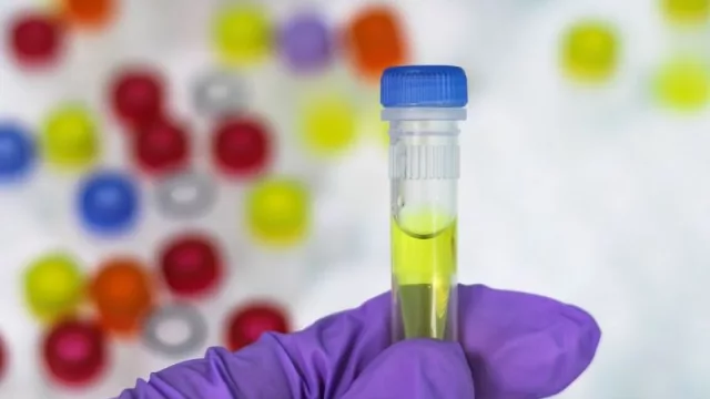 Biotec acumula G. 23.000 millones en emisión de bonos y proveerá al mercado interno 40.000 test para COVID-19