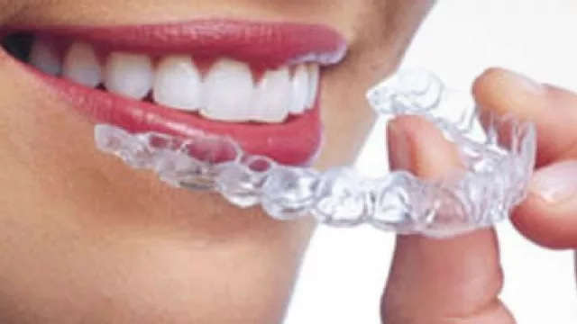 ¿Alinear tus dientes sin que se note? Llega al Paraguay una opción diferente