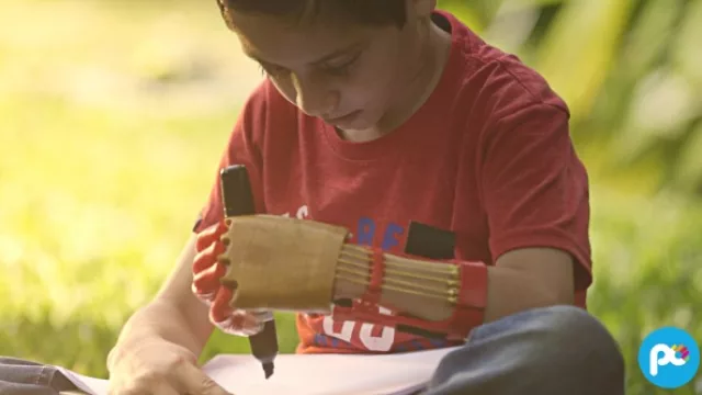 Po supera el centenar de prótesis entregadas