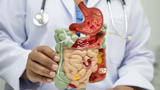 Gastritis, reflujo y enfermedades diverticulares: cómo prevenir las afecciones digestivas más comunes entre los paraguayos